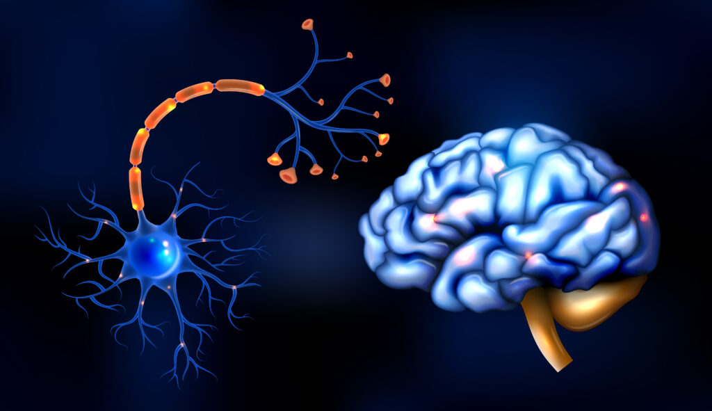 When to Consider Neurotherapy